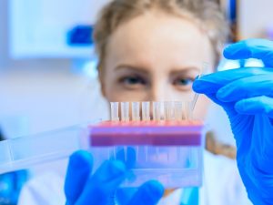 تب زایی (lal test)